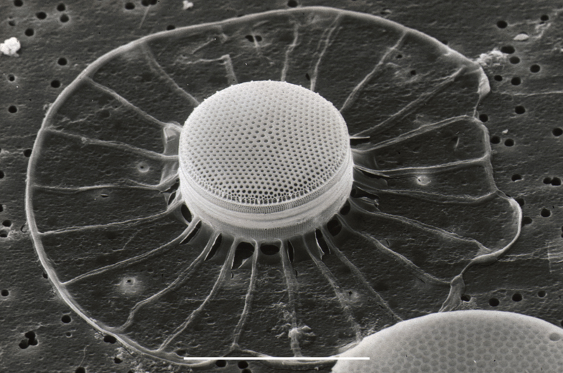 A scanning electron microscope image of a diatom. Courtesy of Australia's Commonwealth Scientific and Industrial Research Organization.